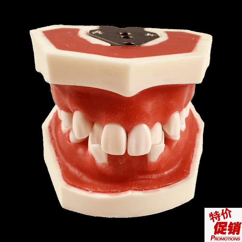 牙模型备牙牙科口腔矫正牙周模型A练习牙结石刮治软牙龈牙列不齐