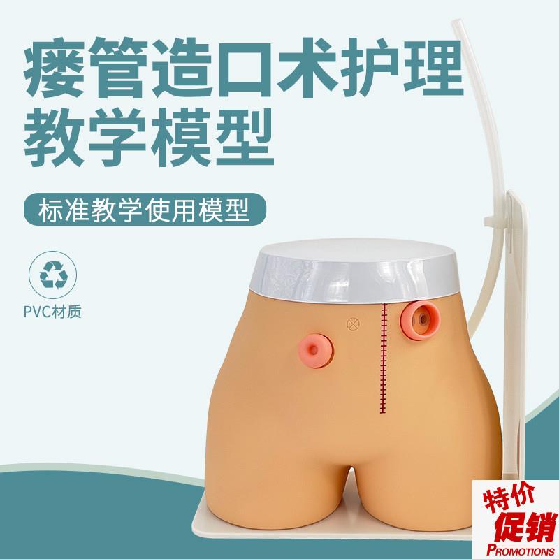 高级瘘管造口术护理模型实验室教学用品基L本护理技能模具回肠造