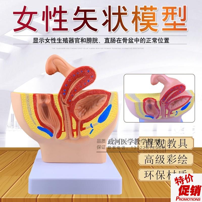 女性盆腔矢状解剖模型女性生殖泌尿系统小型女性盆腔X计生演示包