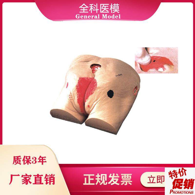 褥疮模型压疮伤口模型高级老年人压疮G褥疮仿真护理模型医教学用,文具电教/文化用品/商务用品,模拟人,淘宝优惠券,粉丝福利购,淘宝优惠卷