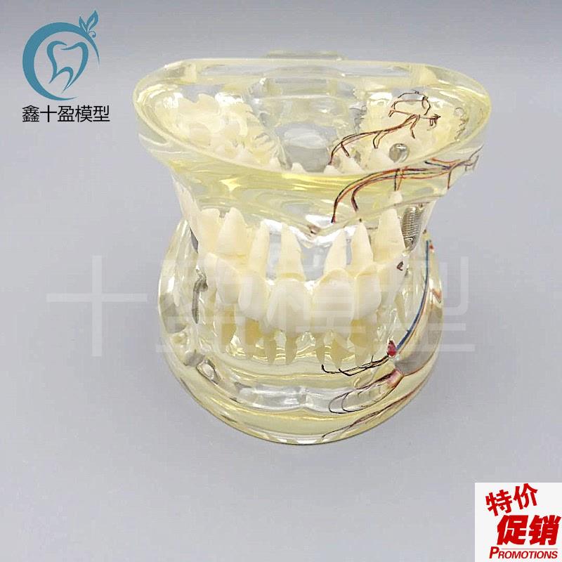 牙科水晶牙齿病理模型M4019-2成人透J明病理牙模型带牙神经和嵌体