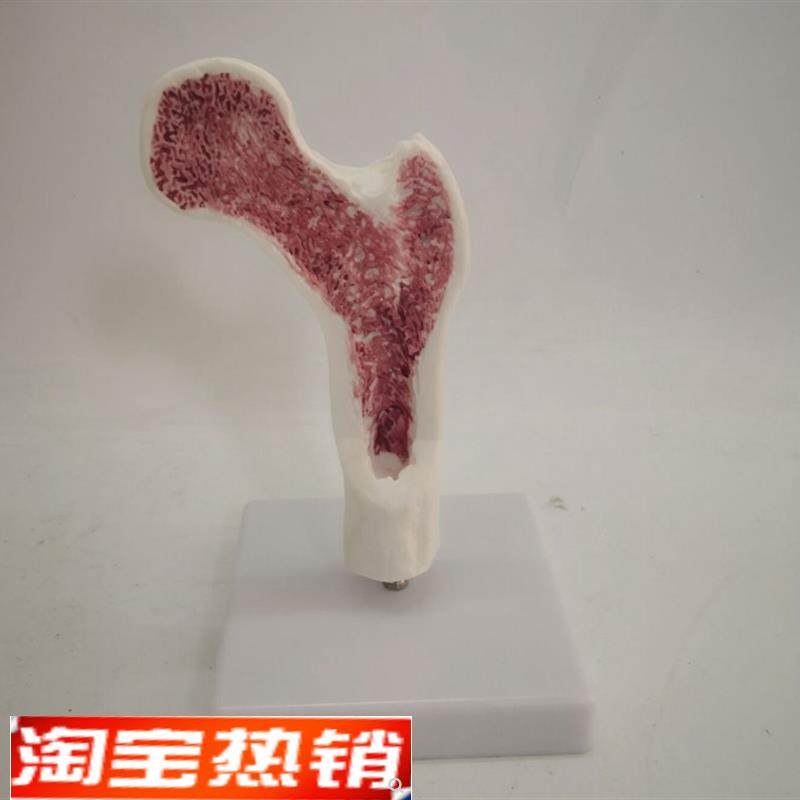 人体骨质疏松股骨头解剖G骨骼医用教学讲解模型
