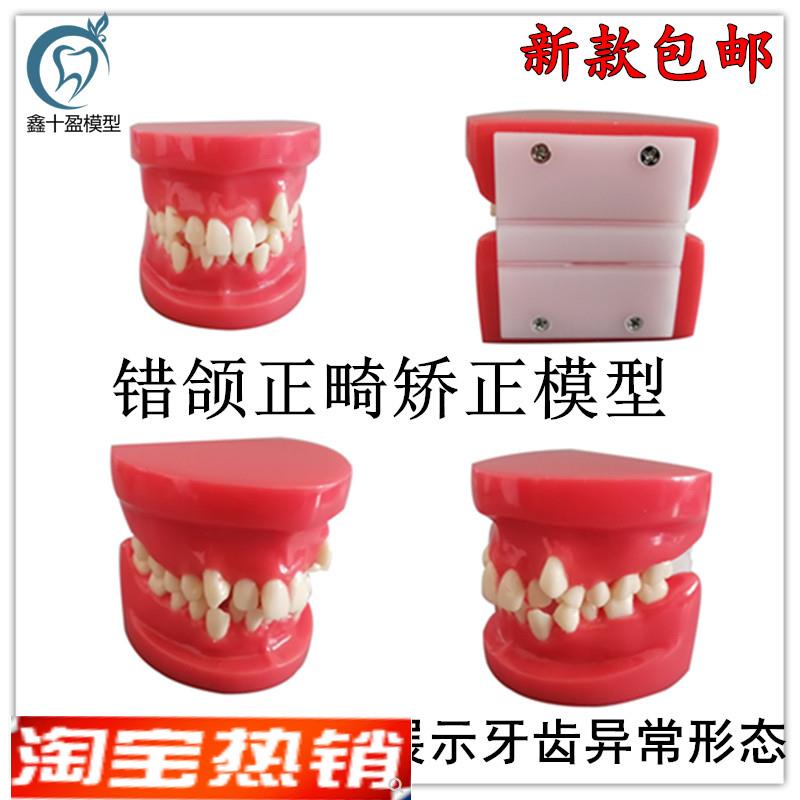 牙齿模型矫正模型练习正畸模型口腔模型牙科模型S牙医练习模型B4