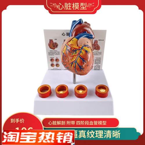 人体心脏模型四阶段血栓可拆卸冠状动脉心血管血液Y循环解剖器官