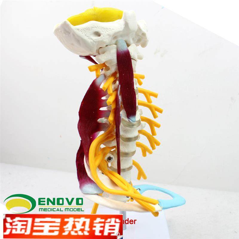 ENOVaO颐诺医学人体颈椎模型颈臂丛神经肌肉模型人体骨骼标本模型,文具电教/文化用品/商务用品,教学标本/模型,淘宝优惠券,粉丝福利购,淘宝优惠卷
