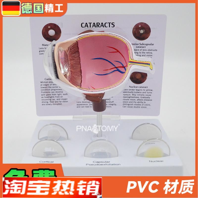德国】眼球模型病理眼球演示教具眼科展示礼O品人体器官解剖模型