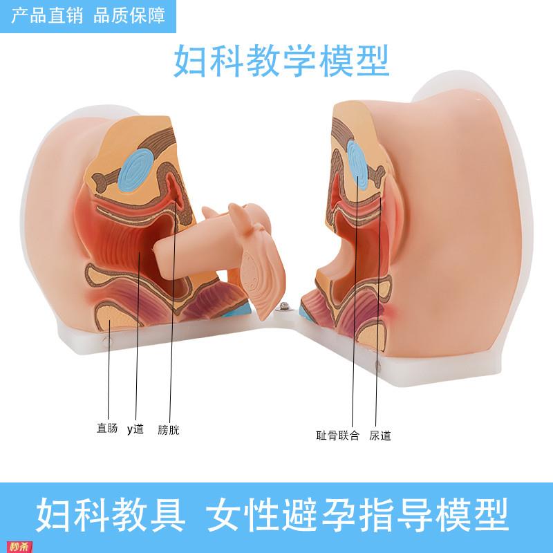 女性避孕器安装指导模型子宫卵巢生殖器官解剖模型医院用学校教学