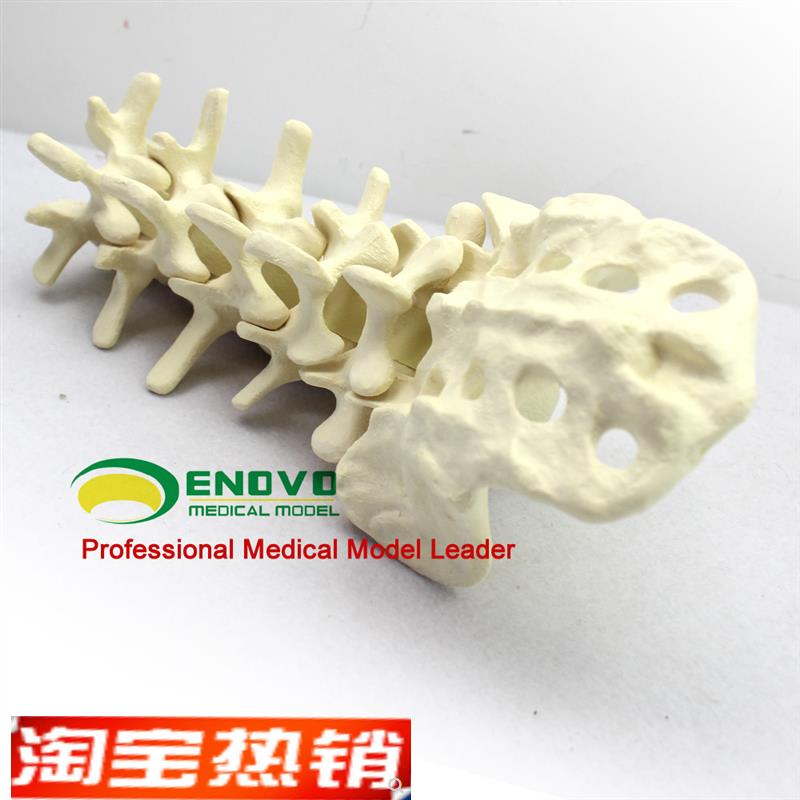 骨科术前Sawbone人体腰椎模型人I工骨模型骨科手术仿真骨演示