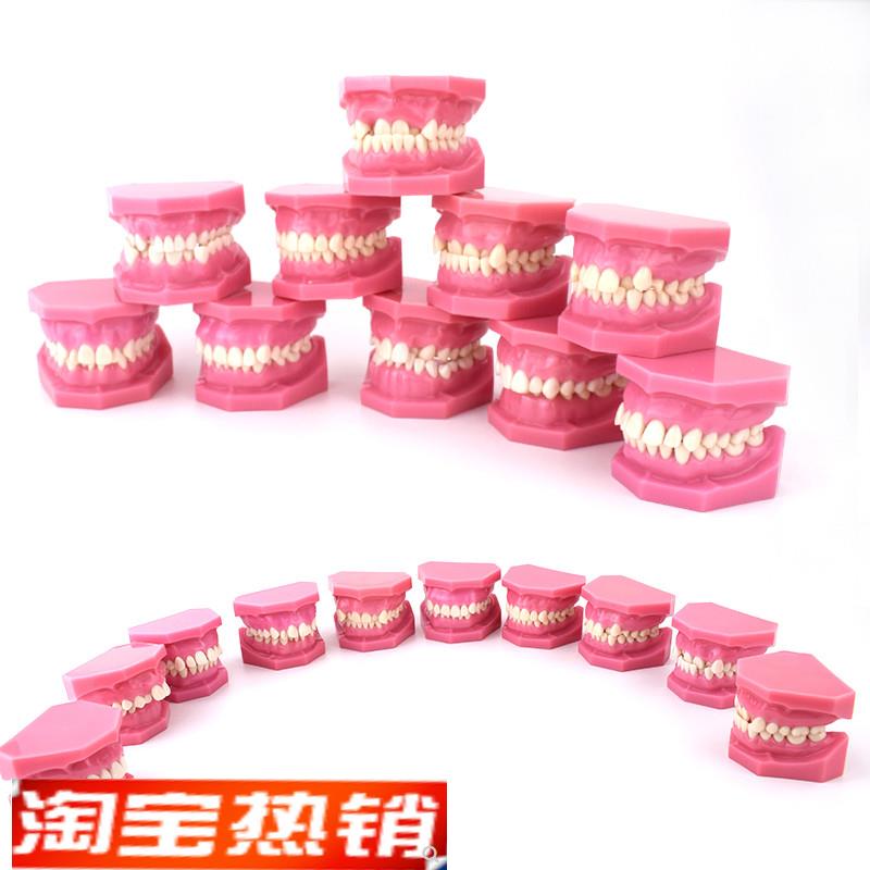 ENOVO颐诺安氏错颌分类模型ANGEL分类错颌畸形S分类演示模型口腔