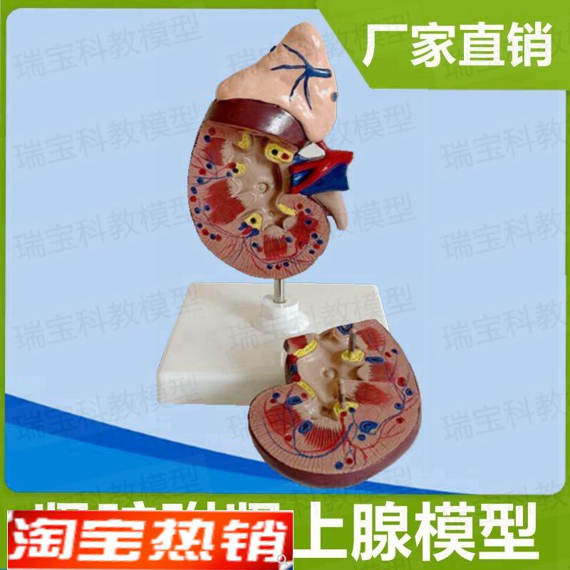 人体肾脏模型自然大可拆卸带y肾上腺泌尿系统外科肾结构输尿管