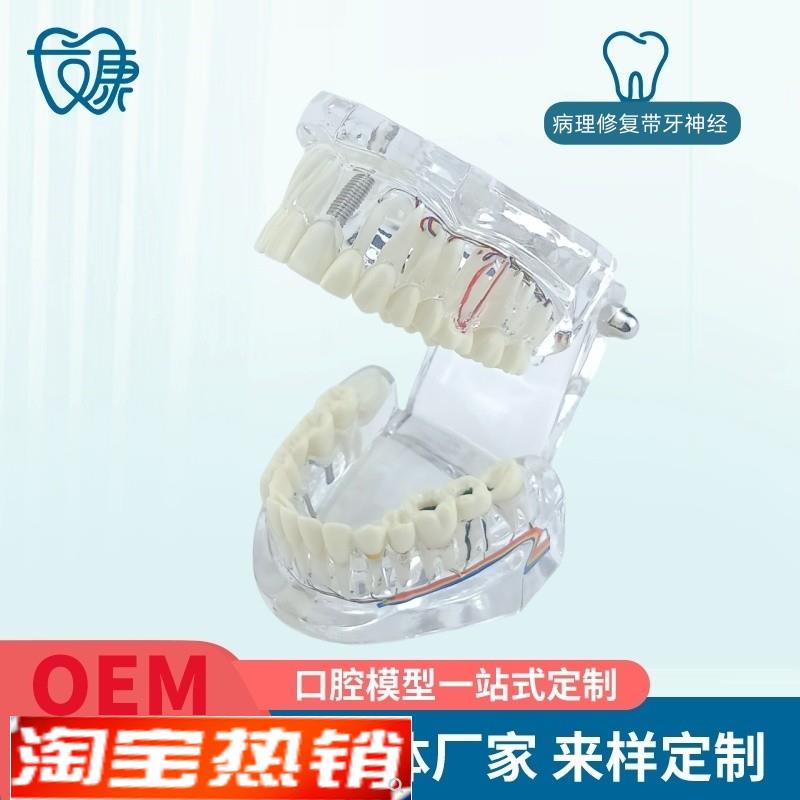 牙齿模型病理修复可拆卸s正畸口腔病理牙模型牙科医患活动沟通