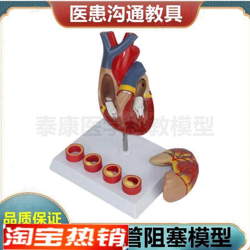 心脏血管阻塞模型冠状动脉管腔狭窄粥样脂L肪斑块硬化血压身高变