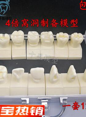牙科4倍大窝洞制备模型四倍牙齿备牙标准G示范嵌体洞型12个M7025