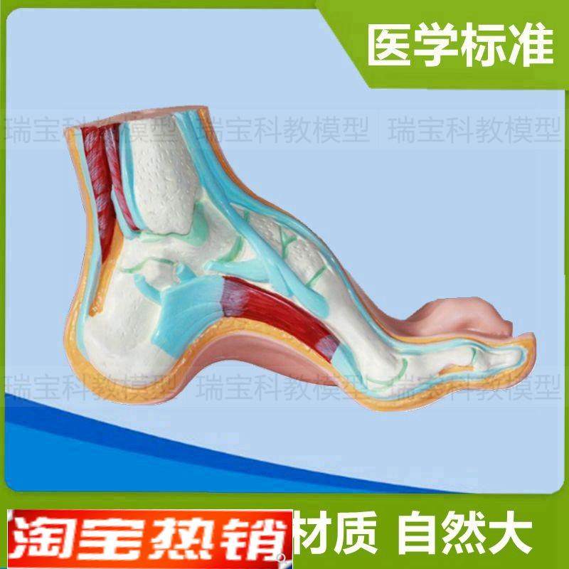 弓形足模型脚部畸形平足畸v形爪形足高弓足人体脚骨仿真1:1