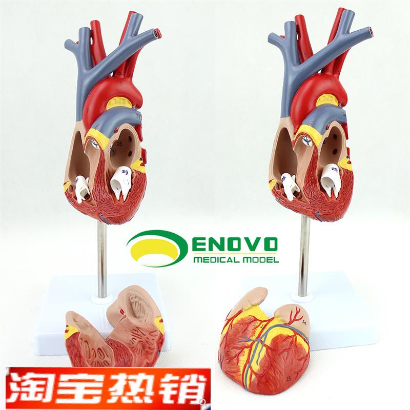 ENOVO颐诺人体心脏模型医学心血管内科J心脏介入解剖教学冠状动脉