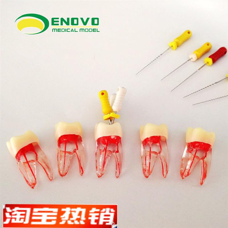 ENOVO颐f诺齿科根管离体牙根管治疗练习摸拟RCT根管教学练习牙体