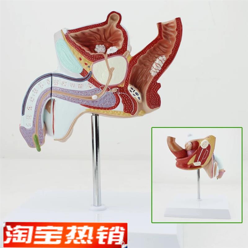 病理男性内外生殖解剖模s型病变生殖解剖模型男泌尿系统疾病模型