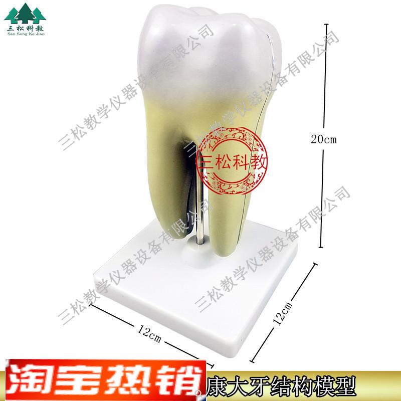 磨牙放大a模型健康大牙结构幼儿园教具生物口腔牙齿教学模具摆件