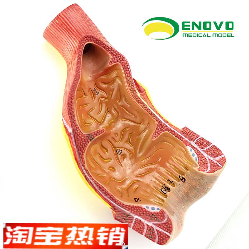 ENOVO正品医用人体直肠肛管z肛门解剖结构模型肛肠科外科消化系统