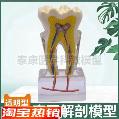 磨牙模型透明牙龈带血管神经口腔牙齿龋齿L变化蛀牙医患牙科牙医