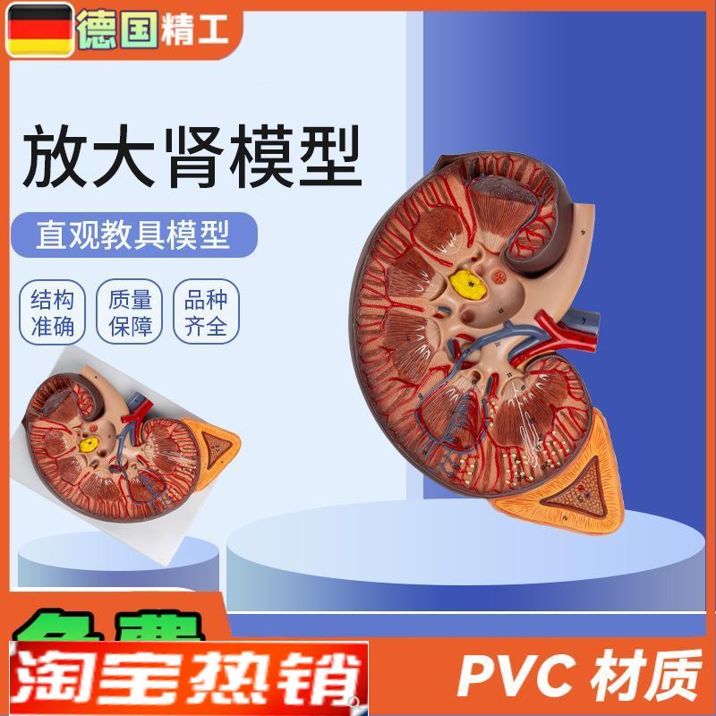 德国】放大肾模型肾解剖附人体医学解剖模型Q教学培训肾上腺放大