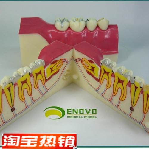 ENOVO颐诺右下后牙组织分解模型牙齿解剖N牙列模型口腔齿科科教学