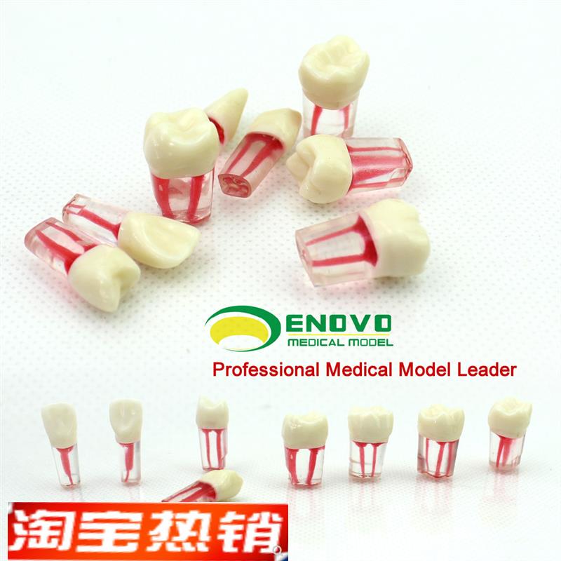ENOVO颐诺口腔科根q管离体牙模型牙体牙髓学根管充填制备8个牙位