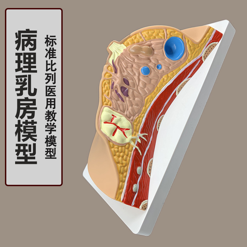 女性病理乳房模型 人体1:1乳房模型 乳腺解剖女性 医.院教学教具