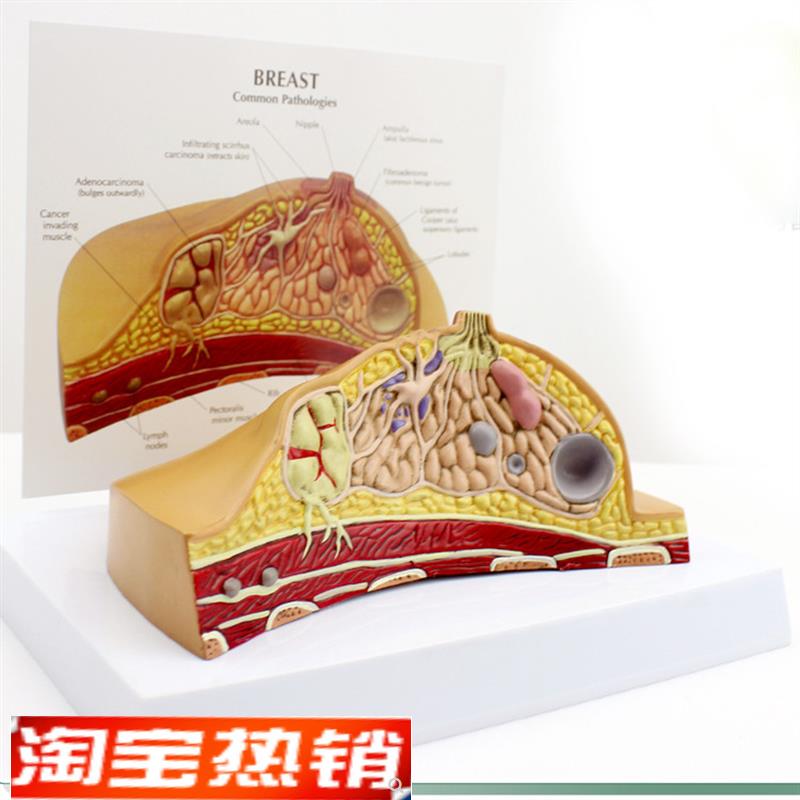 ENOVO颐诺h女性乳房常见病解剖模型乳房乳腺癌肿瘤结节模型母乳哺