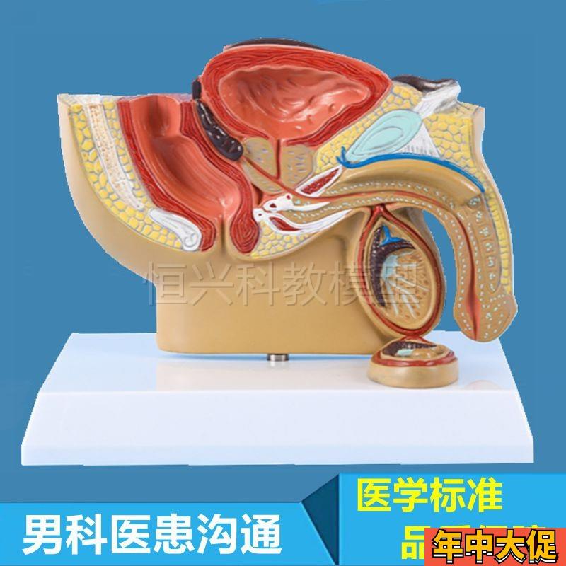 前列腺模型男科生殖m泌尿系统膀胱睾丸医患沟通医药促销礼品肛肠