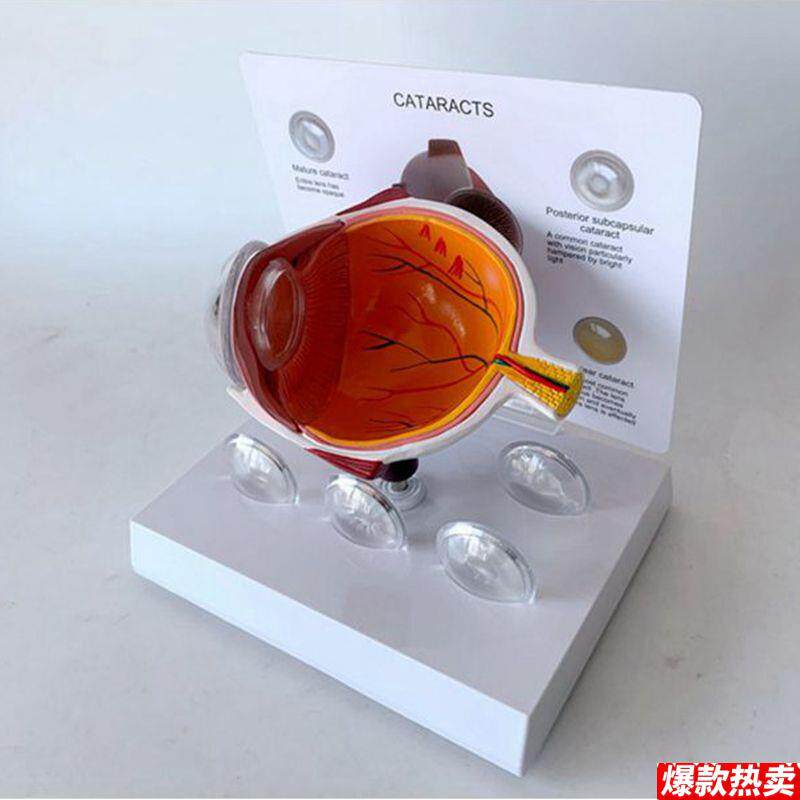 白内障眼睛模u型可拆卸眼科医生用晶状体病变眼底视网膜神经血管