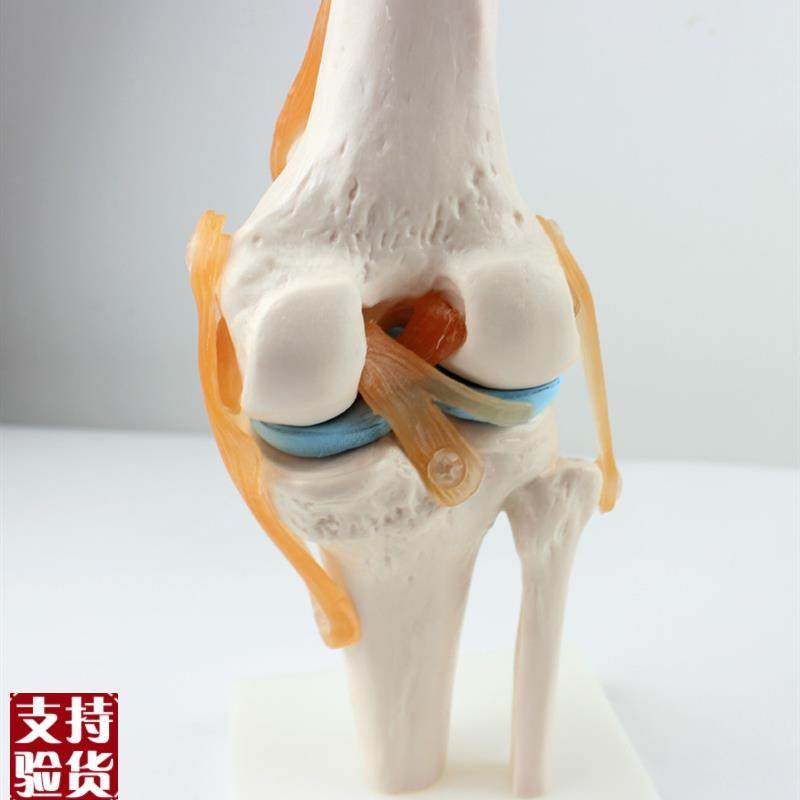 ENOVO颐诺医i学人体功能性膝关节模型韧带滑车关节人体骨关节髌骨,文具电教/文化用品/商务用品,教学标本/模型,淘宝优惠券,粉丝福利购,淘宝优惠卷