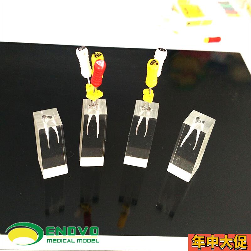 ENOVO颐诺牙体牙髓教学实践模型根E管练习预备充填练习RCT口外操