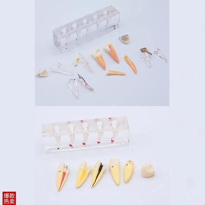 牙科厂里直销商用与正常对比牙模横截面N分解医患沟通模型包邮