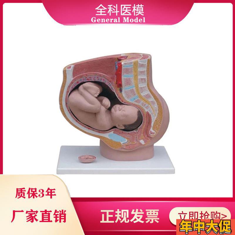 女性盆腔自然大妊娠九个月胚胎模型 女性失状V分娩解剖模型