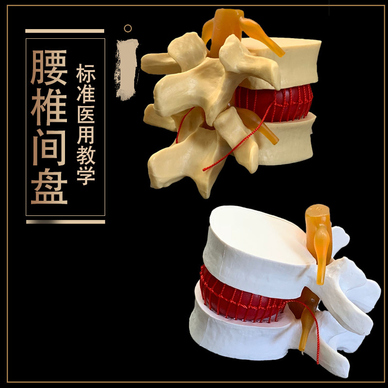 医用人体腰椎间盘TU出演示模w型 腰椎D病变模型 脊柱脊椎模型包邮