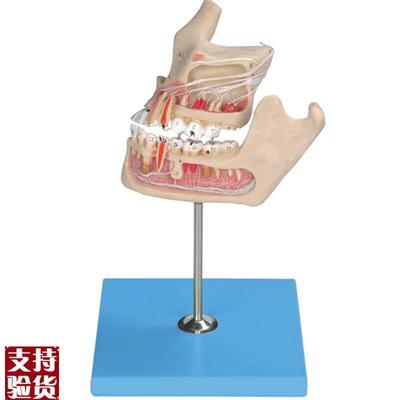 牙体病变模型BW10016