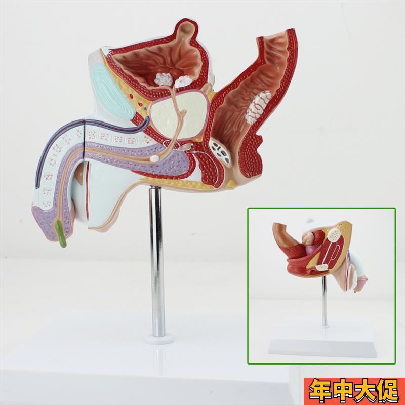 颐诺正品人体男性生殖泌尿疾w病模型男科模型淋病前列腺增生模型