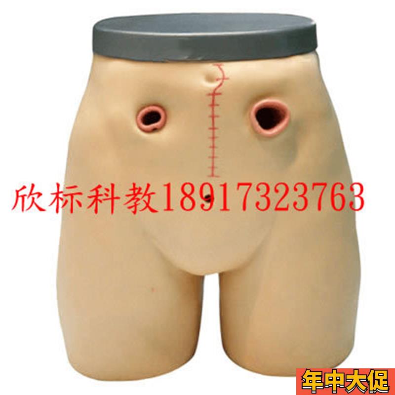 高级瘘管造口术护理模r型  回肠造瘘教学模型 人体教学培训