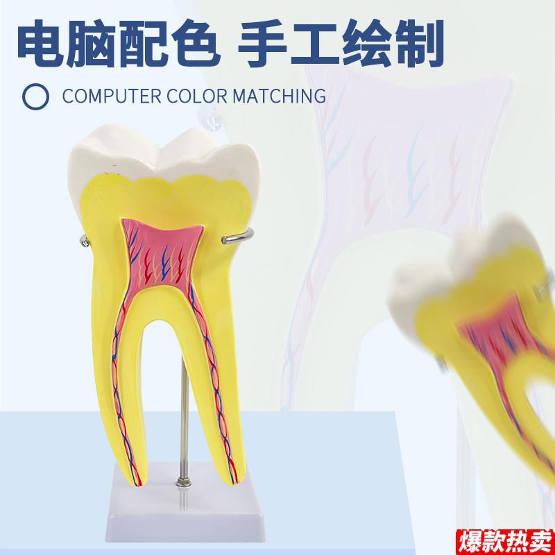 人体磨牙解剖模型幼儿园教具j医学教学大型牙齿通用配底座支架