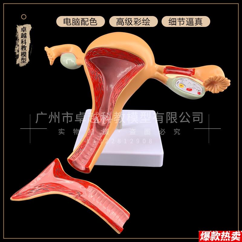 正常子宫模型卵巢病理y病变模型生殖科女性子宫阴道模型包邮