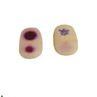 天花病变模块护理模p型天花病毒检查模型医学教学模型护士实习用