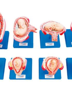 妊娠胚胎发育过程模型42005胎儿形成K发育过程模型双胎子宫模型