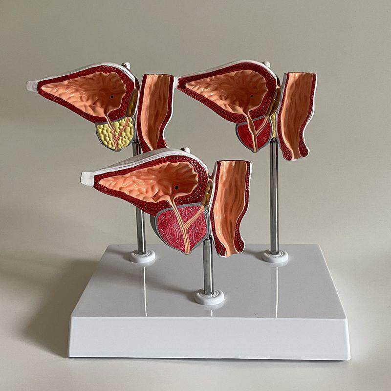 康泰医学模型前列腺健康病变增大生尿道狭窄男科医U药促销生殖膀