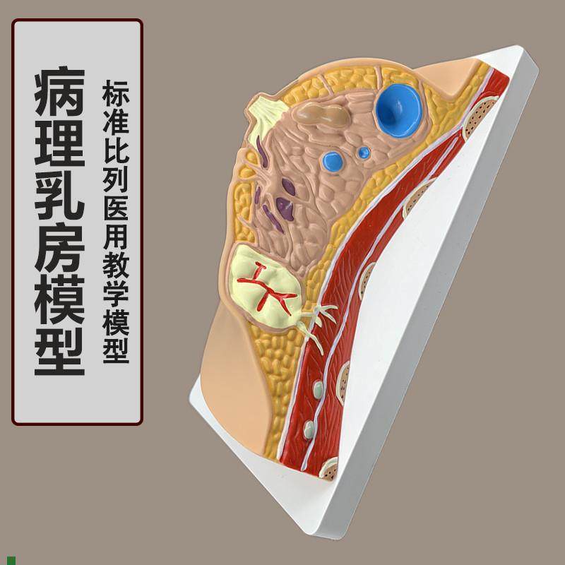 女性病理乳房模型人体1:1乳房模型乳腺O解剖女性医院教学教具