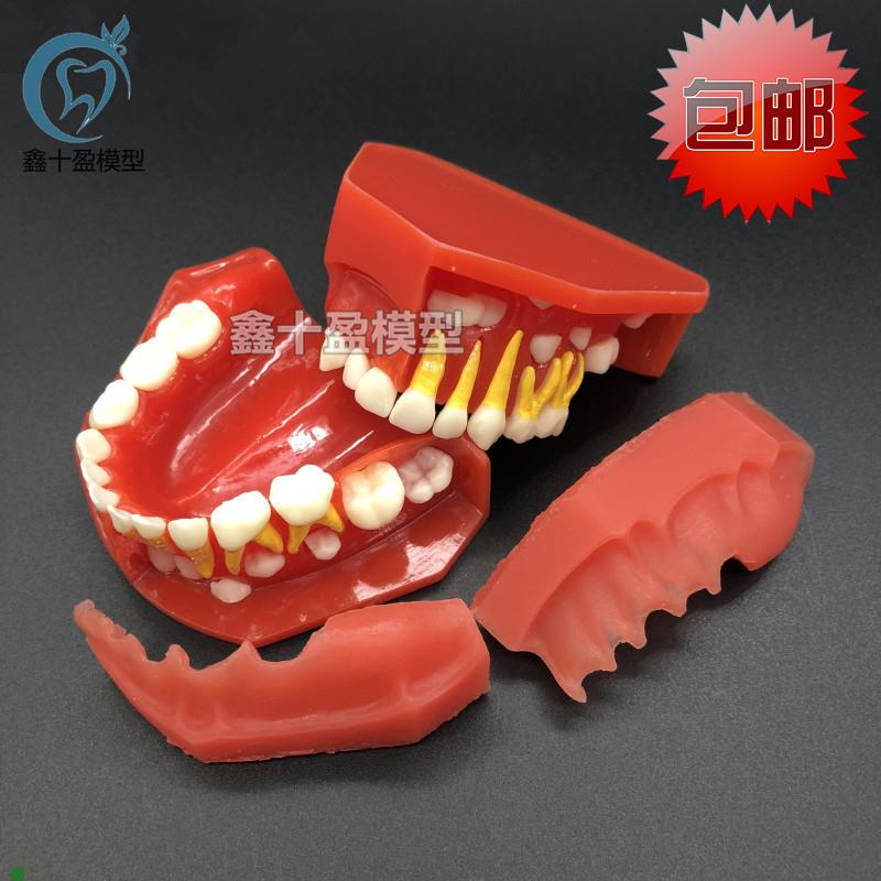 牙科齿科模e型儿童乳牙替换牙齿模型乳恒牙交替展示医患沟通7011