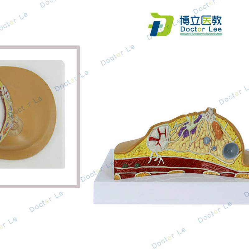 乳腺病变模型乳房模型乳房病变模型解剖模型医U学人体组织模型