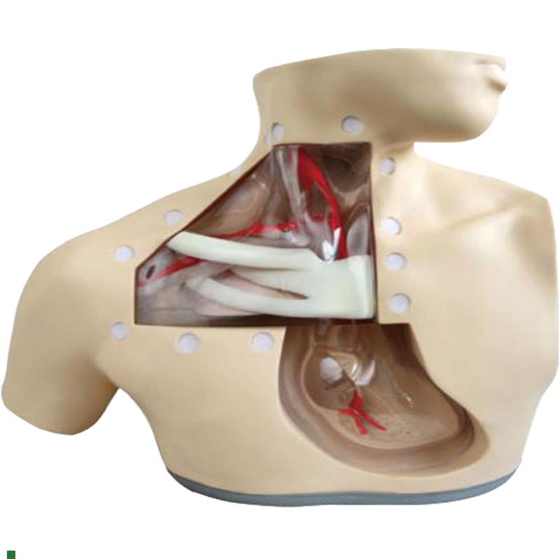 高级肠外营养护理模E型H72护理模型