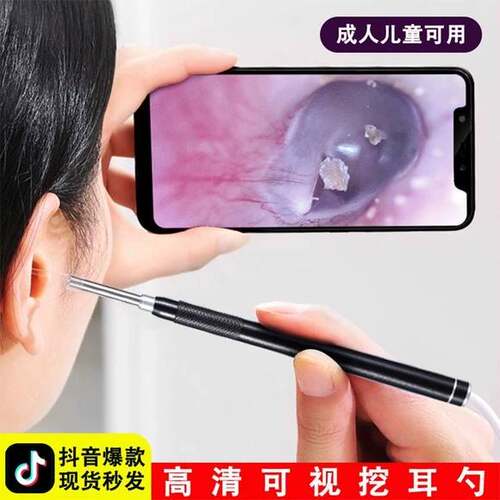 可视挖耳勺高清采摄像头掏