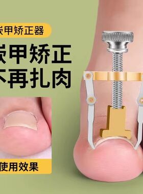 脚拇指指甲盖矫正器脚趾甲校正